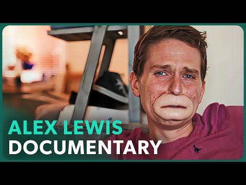 The Extraordinary Case of Alex Lewis