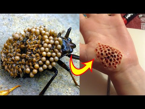 10 Most Dangerous Bugs In The World